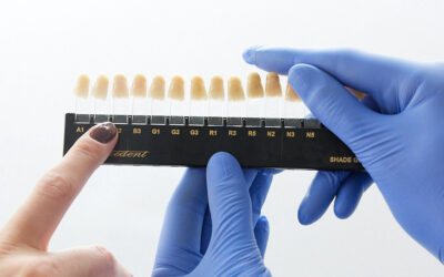 Protezy stomatologiczne w Poznaniu – nowoczesne uzupełnienia zębów w jamie ustnej