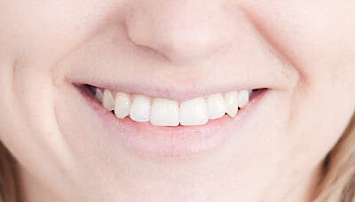 Periodontologia Poznań – jak dbać o zdrowie przyzębia