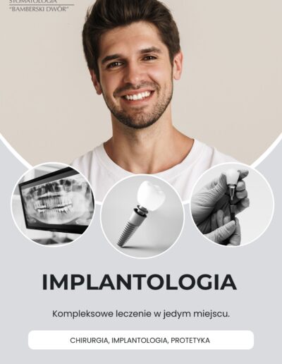 nowoczesne implanty zębów w poznaniu